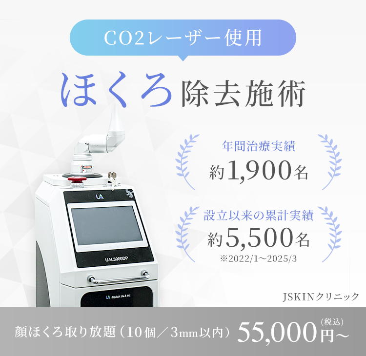 CO2レーザー