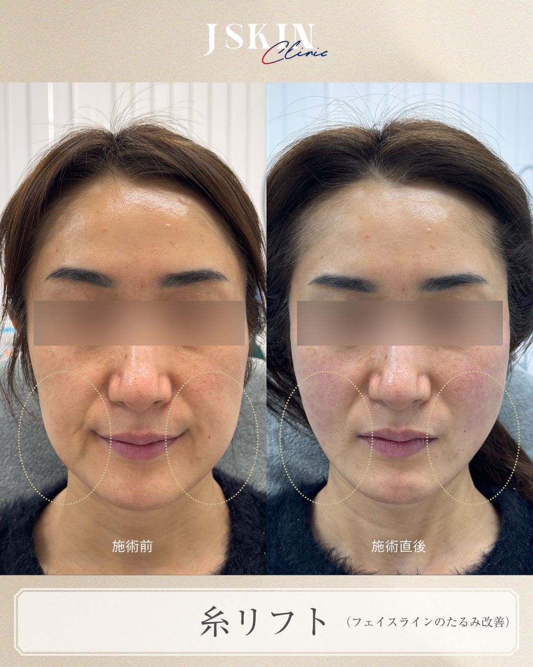 症例写真