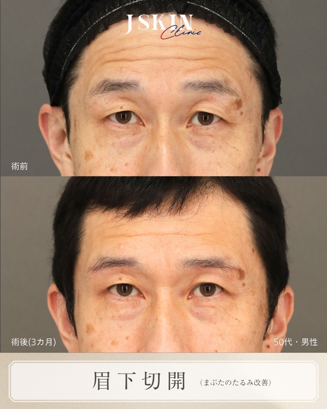 症例写真