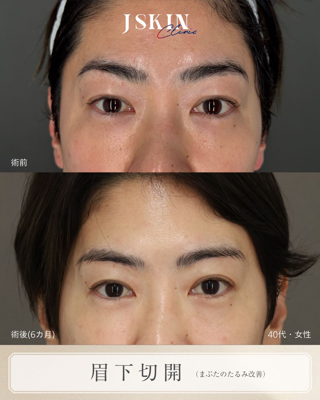 症例写真