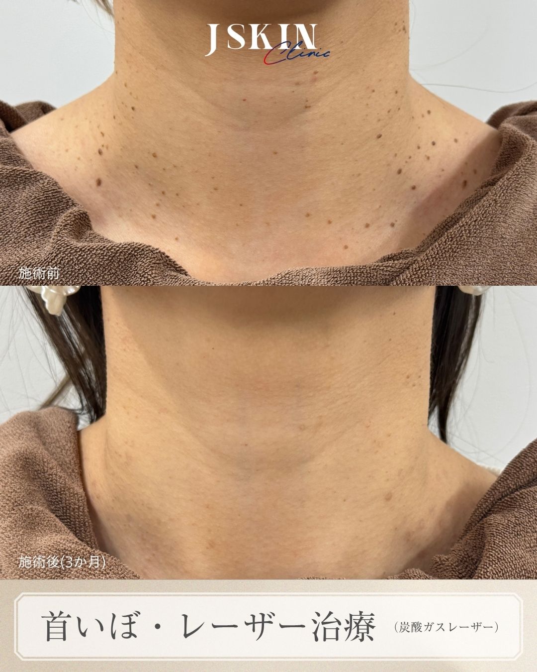 症例写真