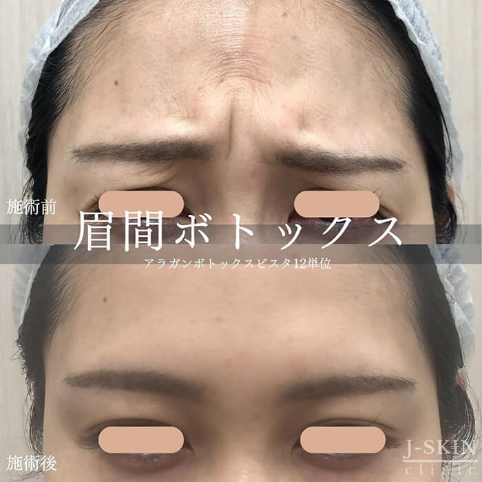 症例写真