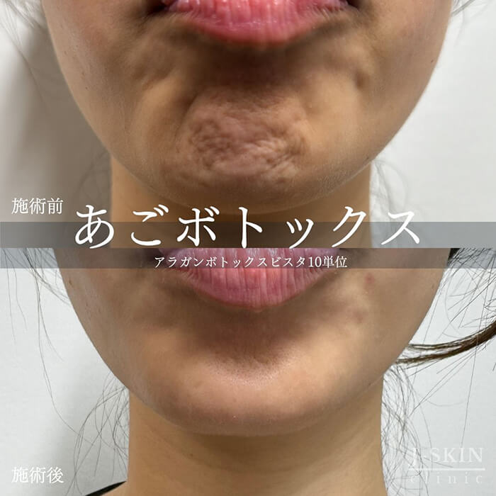 症例写真