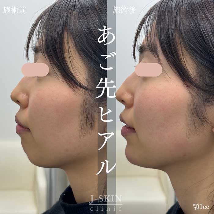 症例写真