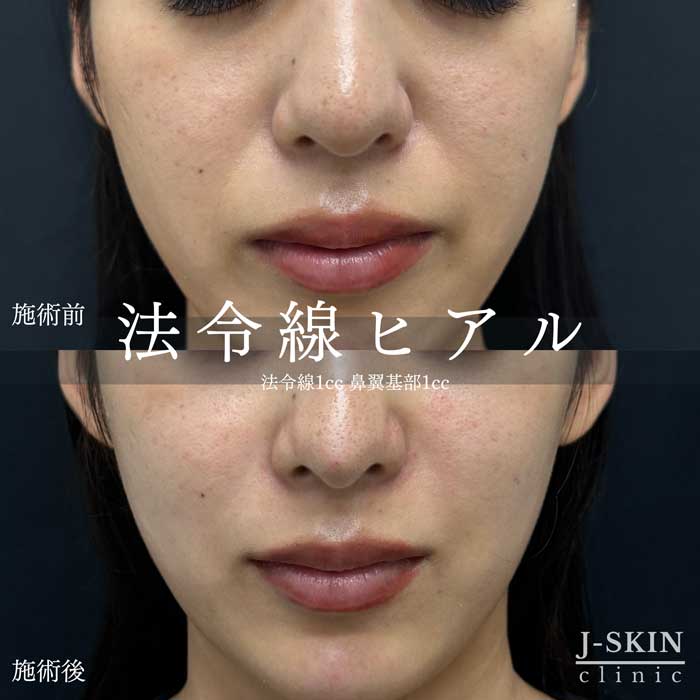 症例写真