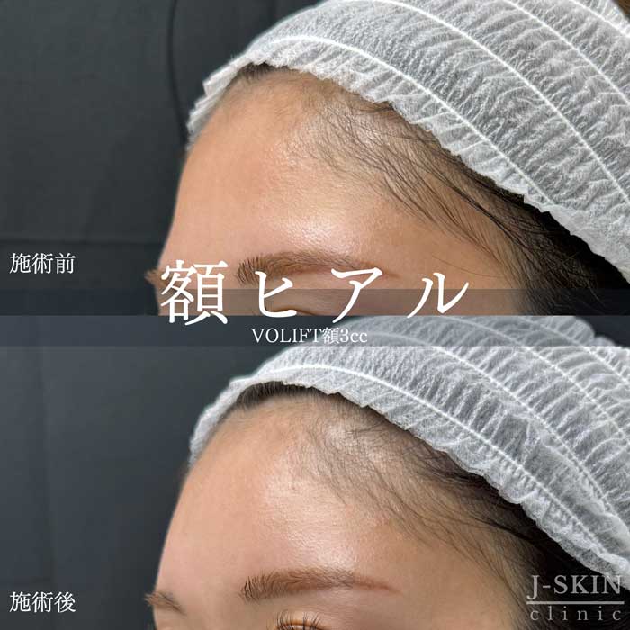 症例写真