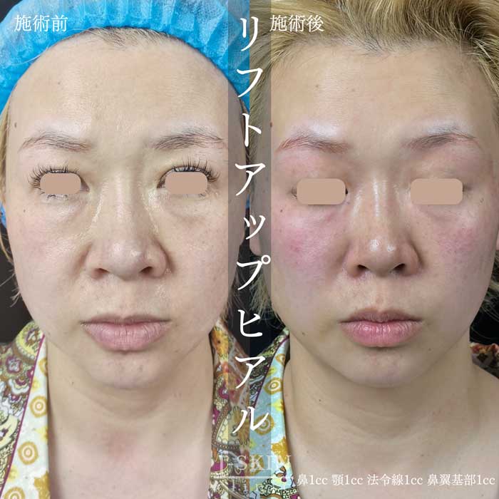症例写真