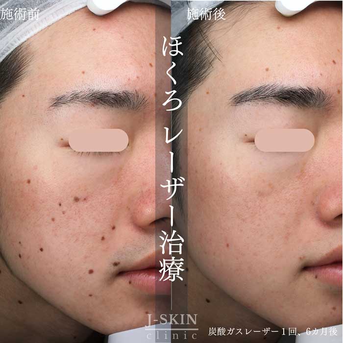 症例写真