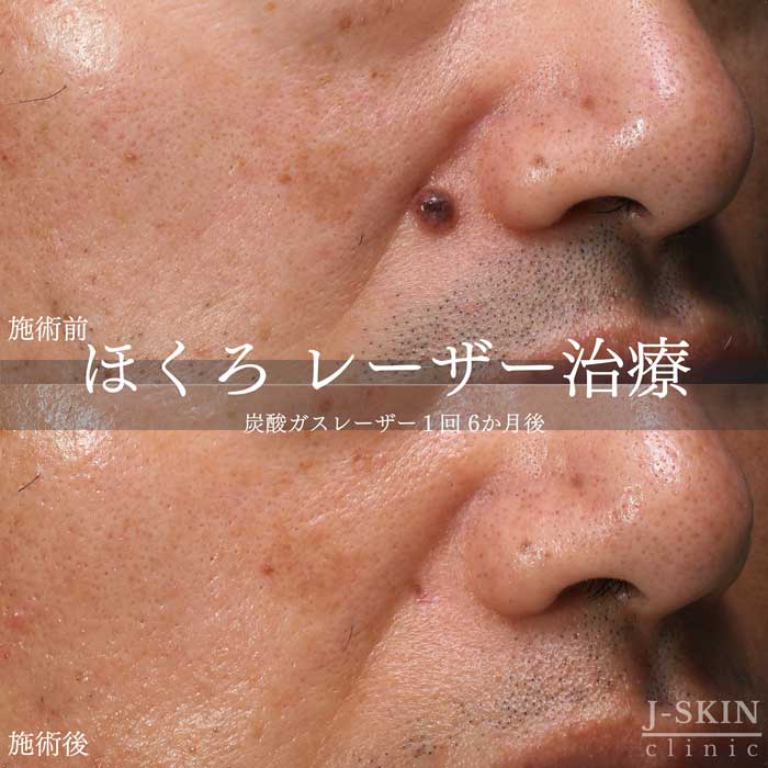 症例写真