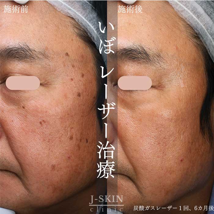 症例写真