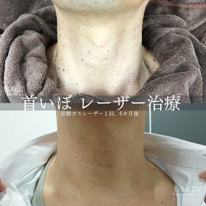症例写真