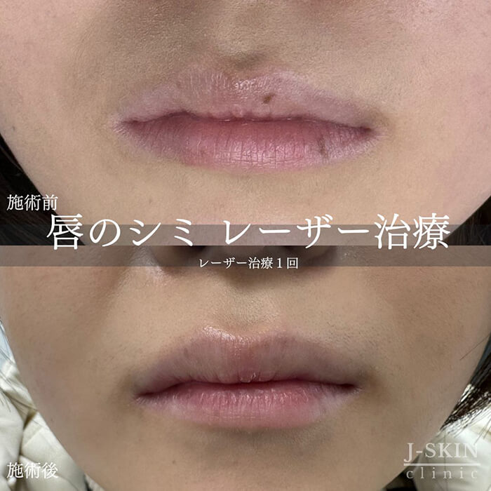 症例写真