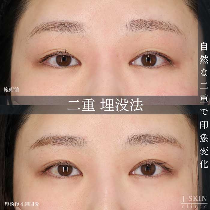 症例写真