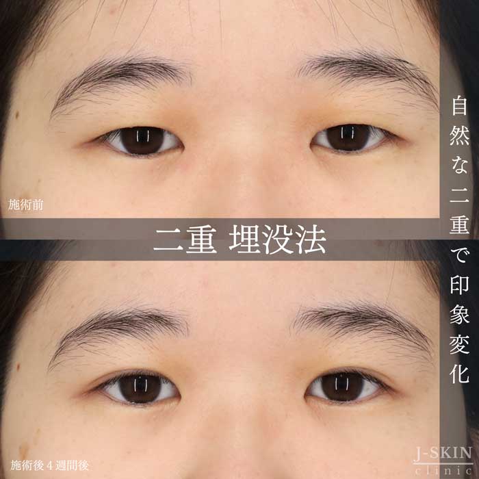 症例写真