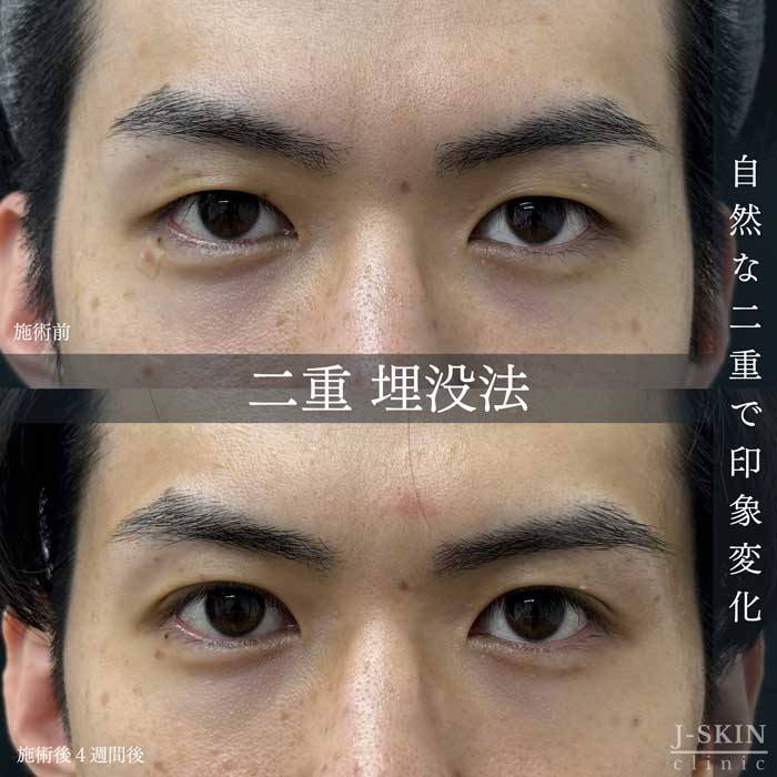 症例写真