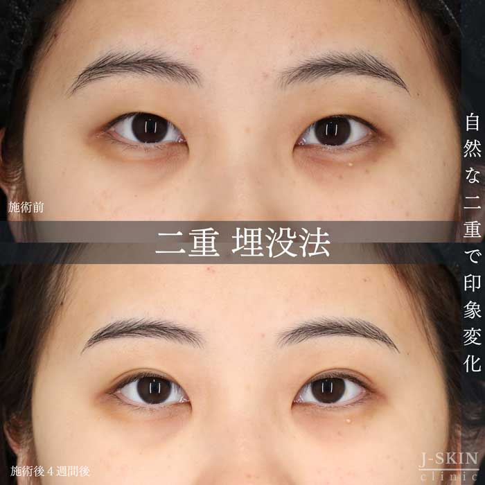 症例写真